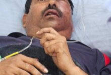 Photo of लखनऊ में पत्रकार पर हमला—क्या आलोचना अब गुनाह बन गई है ?