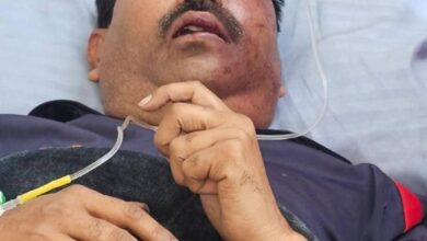 Photo of लखनऊ में पत्रकार पर हमला—क्या आलोचना अब गुनाह बन गई है ?